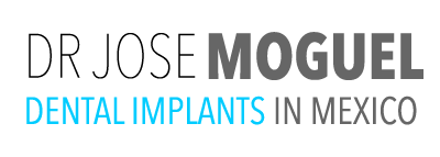 Dental Implants México