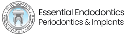 Essential Endodontics of Alliance Essential Endodontics of Alliance
